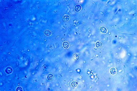  Cryptosporidium! A Microscopic Marvel Lurking Within Our Waters