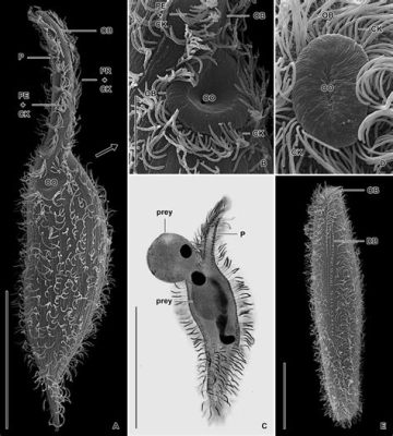   Xibothrix! En mystisk ciliat med en fascinerande livsstil som ett levande snäckhus.